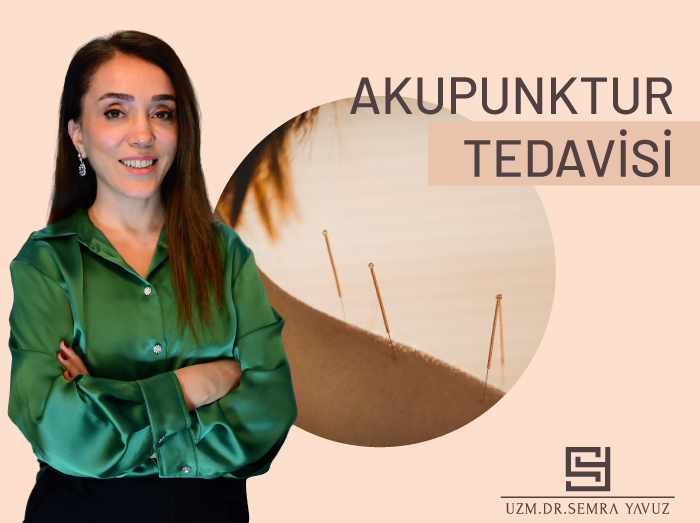 Akupunktur Tedavisi